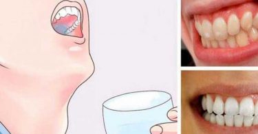 Une astuce puissante pour vous débarrasser des dents jaunes !
